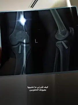 💔🥲. #ايوب_يوسف🖖🏻🤍 