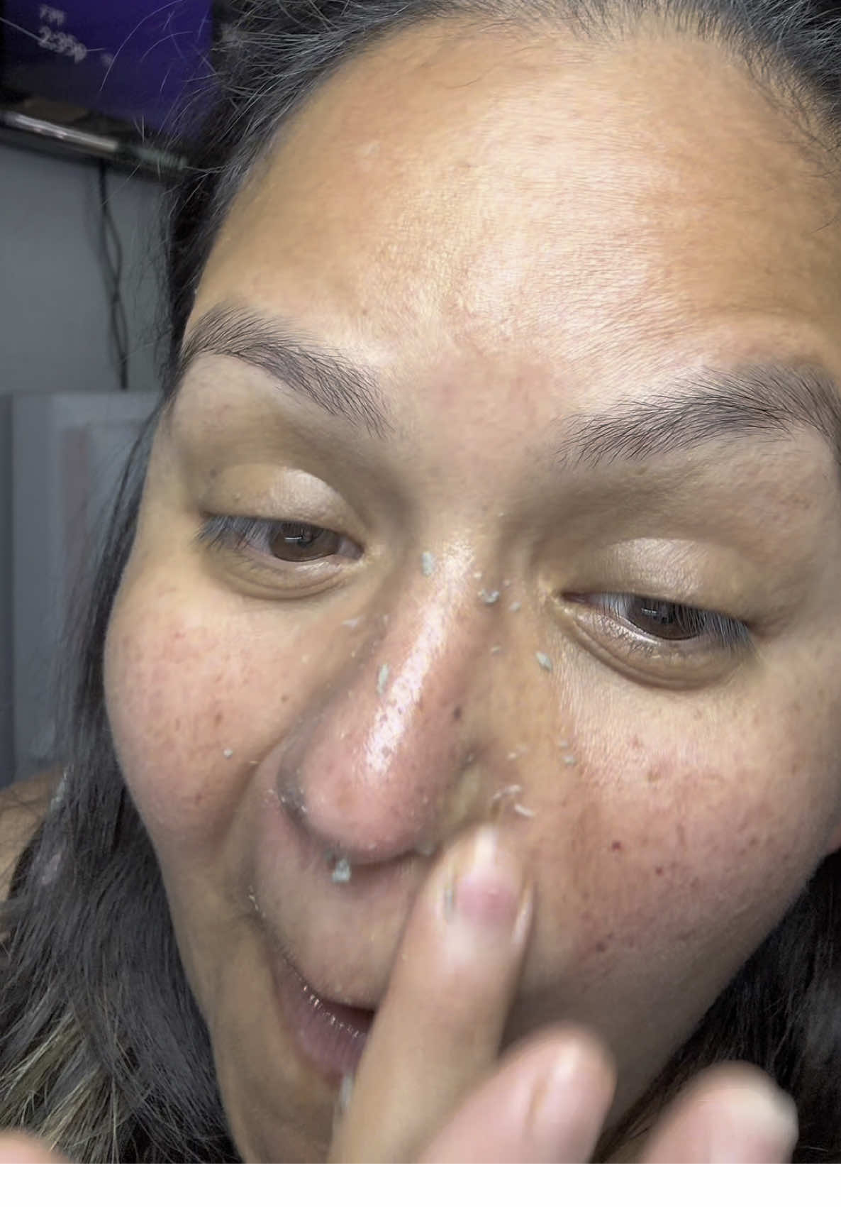 What you guys think? did it work? #fyp #skincare #cleanface #pores #nasty 