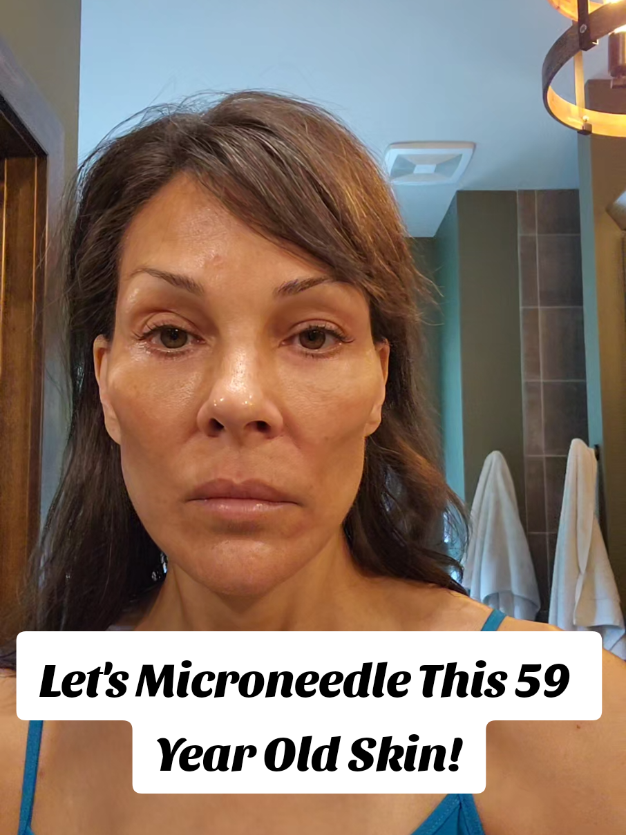 Let's microneedle with Seranova! Not gonna lie, this HURT LIKE HELL lol, but the pain reduced quickly so it's all good ❤️ @seranovabeauty @seranova @seranova_official @eclat beauty #over50skincare #genxtiktokers #genxskincare 