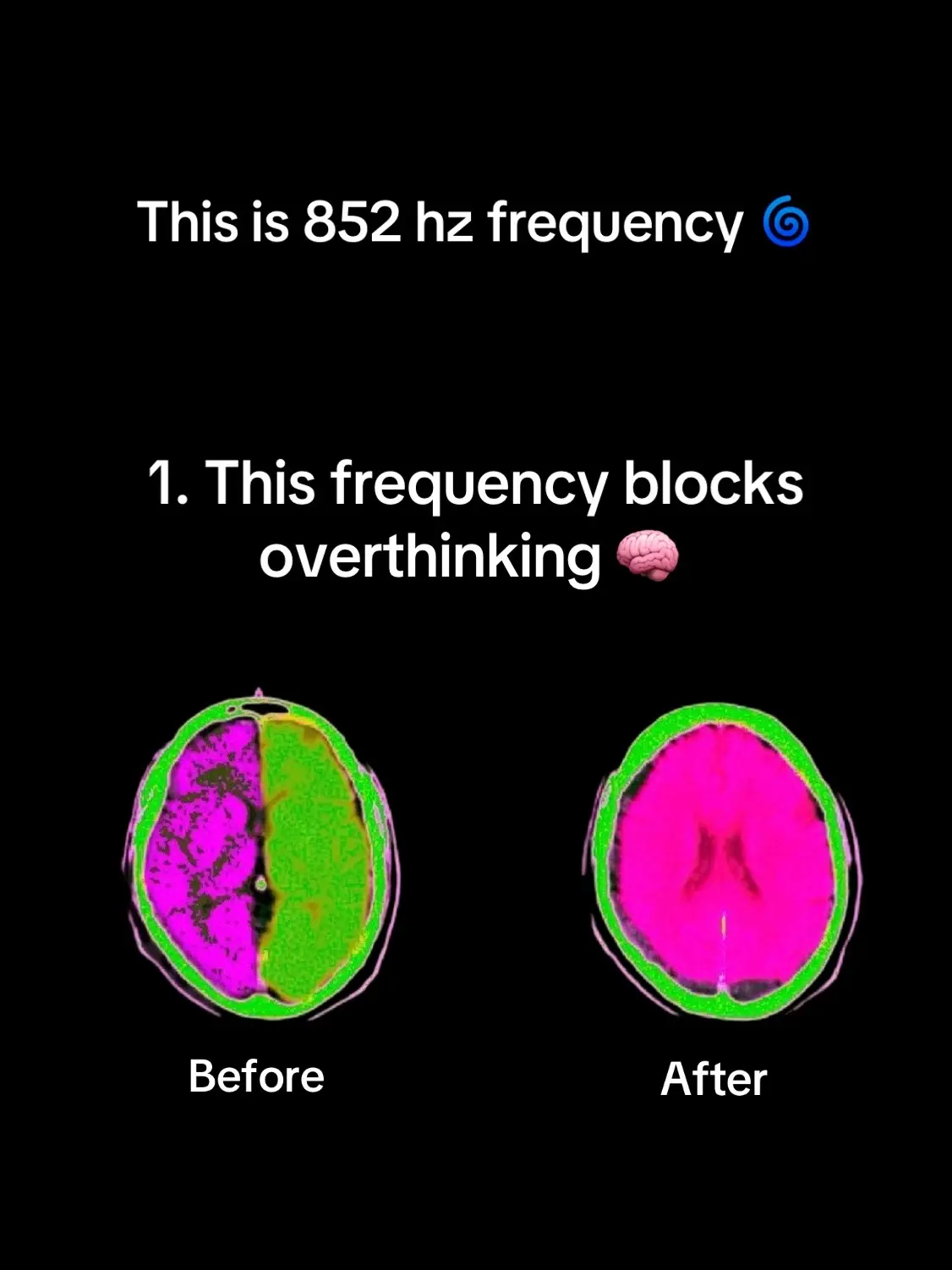 852 hz solfeggio frequencies block your overthinking brain 🧠 #solfeggiofrequencies #852hz #spiritualtiktok #spiritualtok #anxietyrelief #meditation 