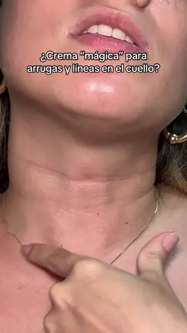 Yo si noto un poco la diferencia #neck #skincare #recomendaciones 