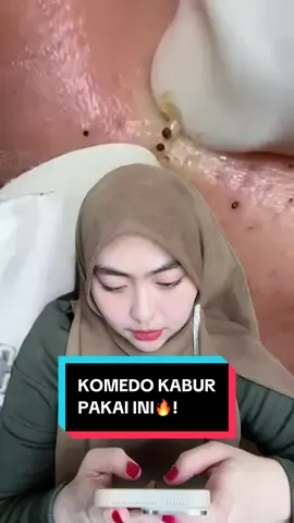 Yang punya komedo susah hempasnya cungg🖐️!  Wajibb pakai ini yaa buktiin sendiri🔥🤏