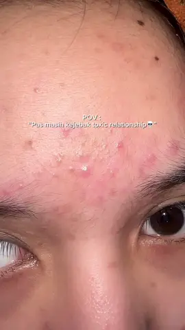 Mugwort gel mask pake 15 menit langsung kerasa efeknya🥹💖 #mugwortgelmaskg2g #acnegelmaskviral 