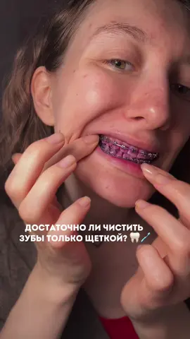 ШОК эксперимент😳 Что будет с зубами, если чистить их толко щеткой?  #эксперимент #бьюти #гигиена #брекеты УЗ 