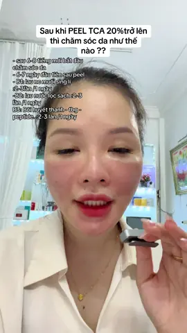 #GOLDSPA Hướng dẫn chăm da sau peel TCA . #ĐÀOTAOHOCVIEN #dược_mỹ_phẩm_châu_âu_chính_hãng #Khoahọc_Antoàn_Hiệuquả #PEELTCA 