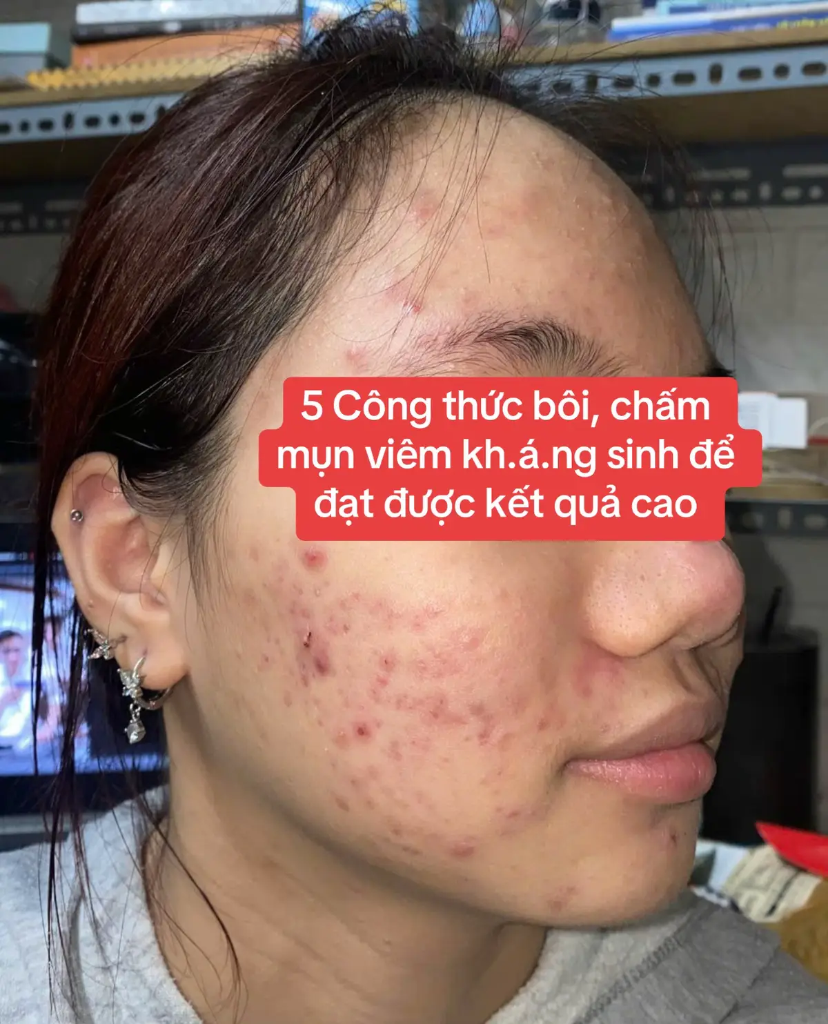 Mun #bacsiluonghuyenn #feedback #LearnOnTikTok 