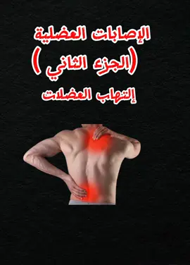 الجزء الثاني)الإصابات العضلية )