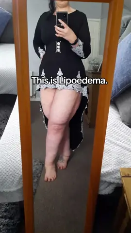 This is Lipoedema. #fy #fyp #lipoedema #awareness #lipedema 
