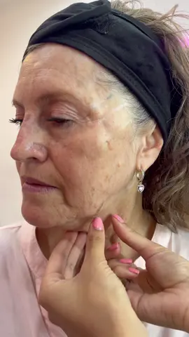 👀 ¿10 años menos? ¡Sí, se puede! 😍 Después del Baby Face, nadie la reconoce... porque ahora parece de 20 😏✨ ¿Tú también quieres ese cambio BRUTAL? Comenta “BRUTAL” y te contamos todo 💌 #magnificatubelleza #babyface #colombia #fullface #face #cara 👀 ¿10 años menos? ¡Sí, se puede! 😍 Después del Baby Face, nadie la reconoce... porque ahora parece de 20 😏✨ ¿Tú también quieres ese cambio BRUTAL? Comenta “BRUTAL” y te contamos todo 💌 #magnificatubelleza #babyface #colombia #fullface #face #cara