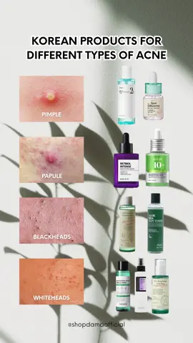 Got stubborn blackheads, whiteheads, pimples, or papules? Here’s your K-beauty rescue line-up!  For pimples: ANUA BHA 2% Gentle Exfoliating Toner & AXIS-Y Spot The Difference Blemish Treatment, your instant spot saver For papules: SOME BY MI Retinol Intense Reactivating Serum or ANUA Azelaic Acid 10 Hyaluron Redness Soothing Serum to calm redness and smooth bumps For blackheads: AXIS-Y Daily Purifying Treatment Toner or BENTON Aloe BHA Skin Toner to deeply unclog pores For whiteheads: SOME BY MI AHA BHA PHA 30 Days Miracle Toner, COSRX AHA/BHA Clarifying Treatment Toner, or AXIS-Y PHA Resurfacing Glow Peel to sweep away buildup and refine skin texture No matter which kind of acne you’re dealing with, there’s a K-beauty solution ready for you! Which one are you reaching for first?👇 #kbeautyproducts #acnecare #acneroutine