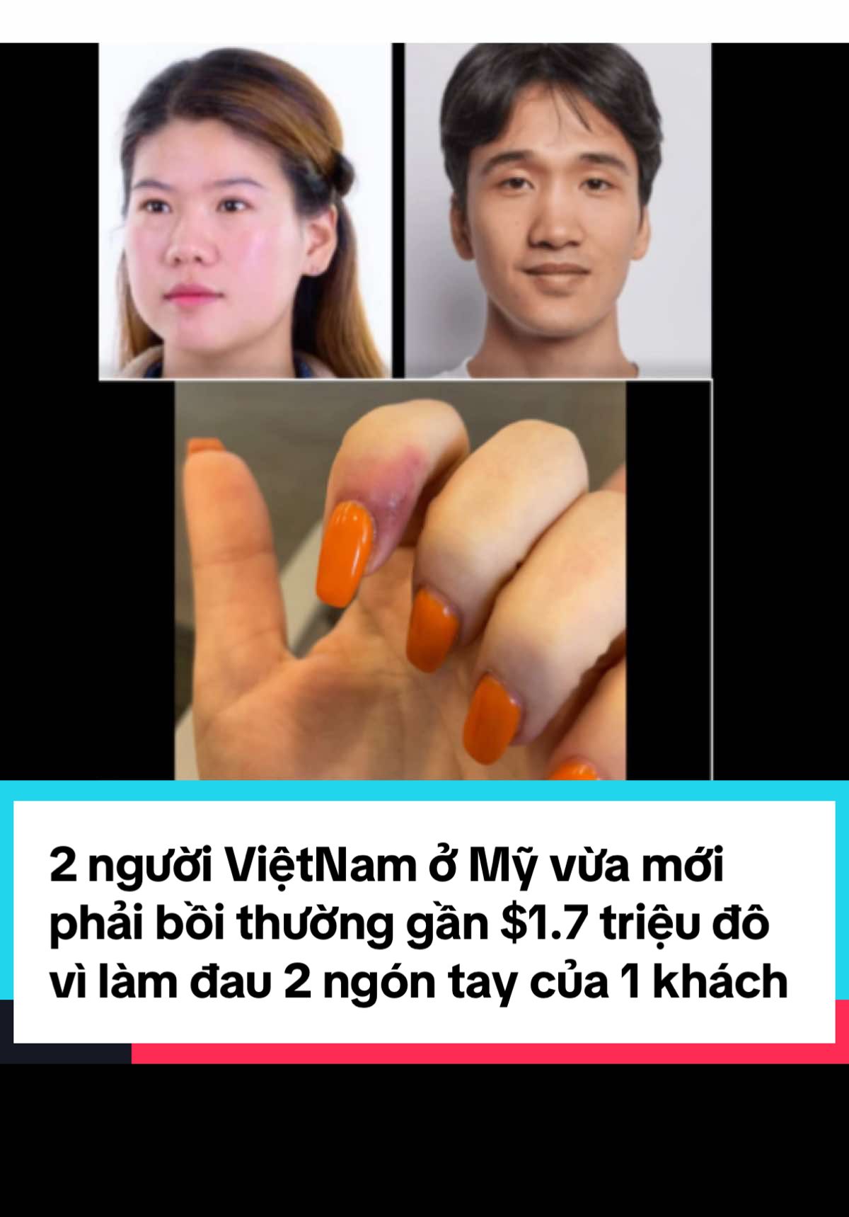 1 triệu 700000 đô la !!!