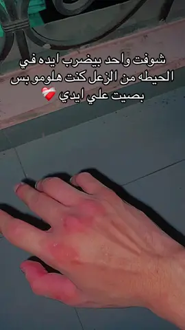#fyp 