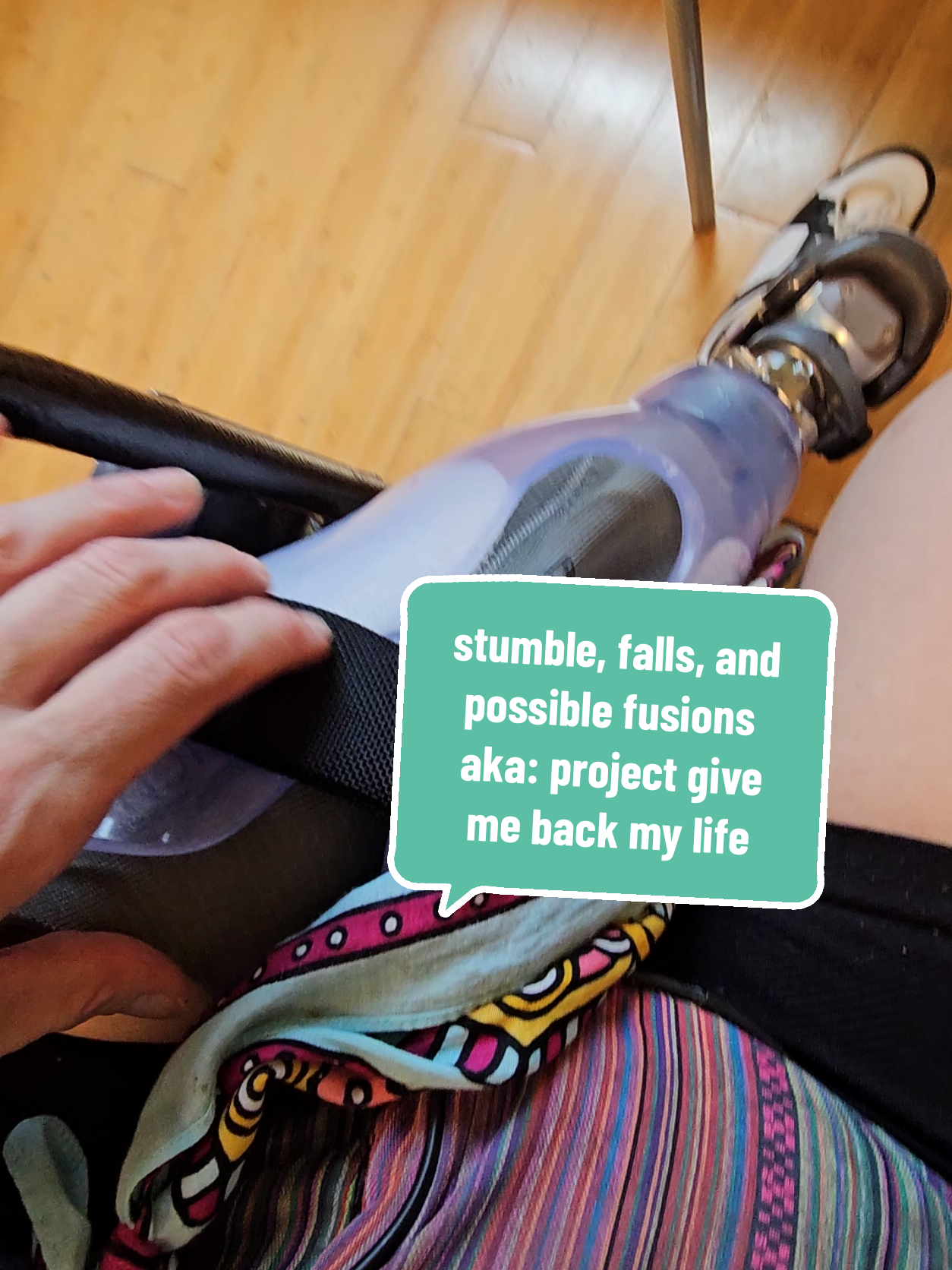 Took a tumble outside of the prosthesis place 2 days ago on the concrete ... and again as I was leaving. we are now discussing finding out the requirements for surgery if we were approved for me to get #osseointegration  I want my life back. the quality has severely dropped these last few years and I desperately want to do things again. its been hard to be on socials other than fb but ew  fb.  I want to do things without my leg falling off because my weight changed during the day. ao much more you guys have no idea.  I miss life.  and honestly my head is still messed up from the whole thing at walmart,  it makes me randomly cry and makes me want to hide again.  wtf is wrong with people?  why do i keep having these things happen? each time i go to my car i feel sick thinking about grabbing my door handle and now, we'll i always locked my doors when getting in but now I lock them and wait. wait to see if ill get confused again and not know where I am and the confusion was horrible. and that guy. I vaguely recall what he looked like but there is nothing that I can confirm enough to give to police and since I didnt want to believe I was drugged because that over reacting.. with my health it would be  a stroke. many doctor appts and we believe I was drugged.  sometimes I just want to hide... and there's the agoraphobia. . . . #peglegpersephone #fyp #prostheticleg #prosthesis #fallinjury #pain #bruised #hippiepirate #mnpenquin #disabled #hopeful #amputee #amputeegirl #mngirl #staypositive #disabled #disabledtiktok #disabledcommunity #depression #imisslife 