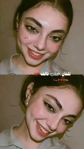 #اي و الله يذبح طعم شفايف🫦
