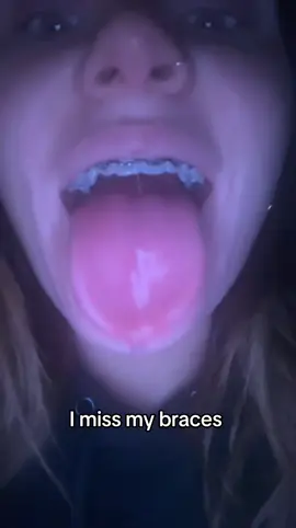 #viral #braces #fyp #sad 