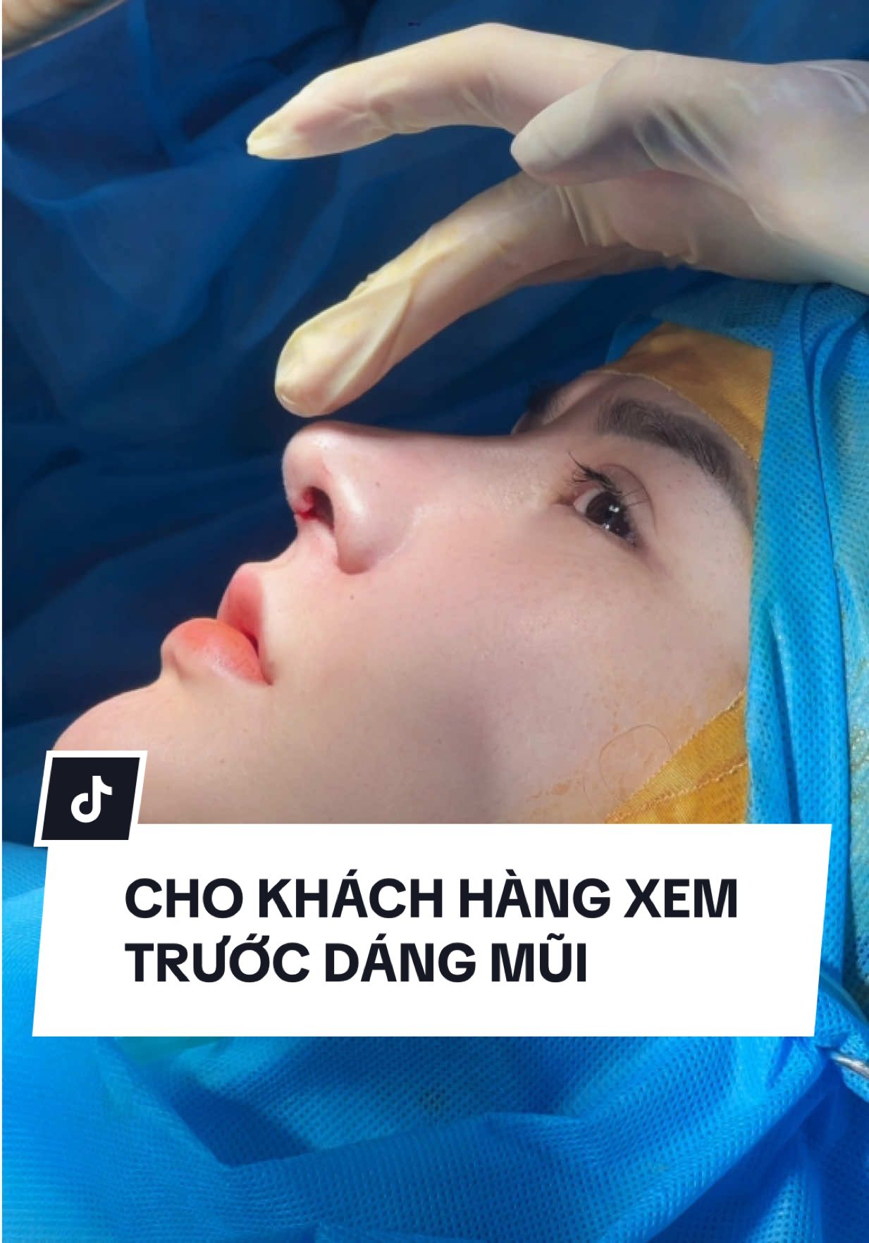 Chốt dáng thôi mà đã đẹp , đã sang thế này 😎#xuhuong #viral #nangmui #muitrunghoa #suamuihong 