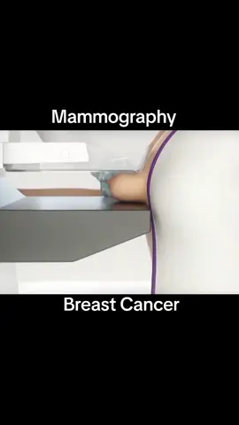 🩺 Mammogram 101! Early detection saves lives 💖 Here’s what you need to know about breast cancer screening 👇 #Mammogram #BreastCancerAwareness #WomensHealth #Radiology #PreventiveCare #medicaltiktok 