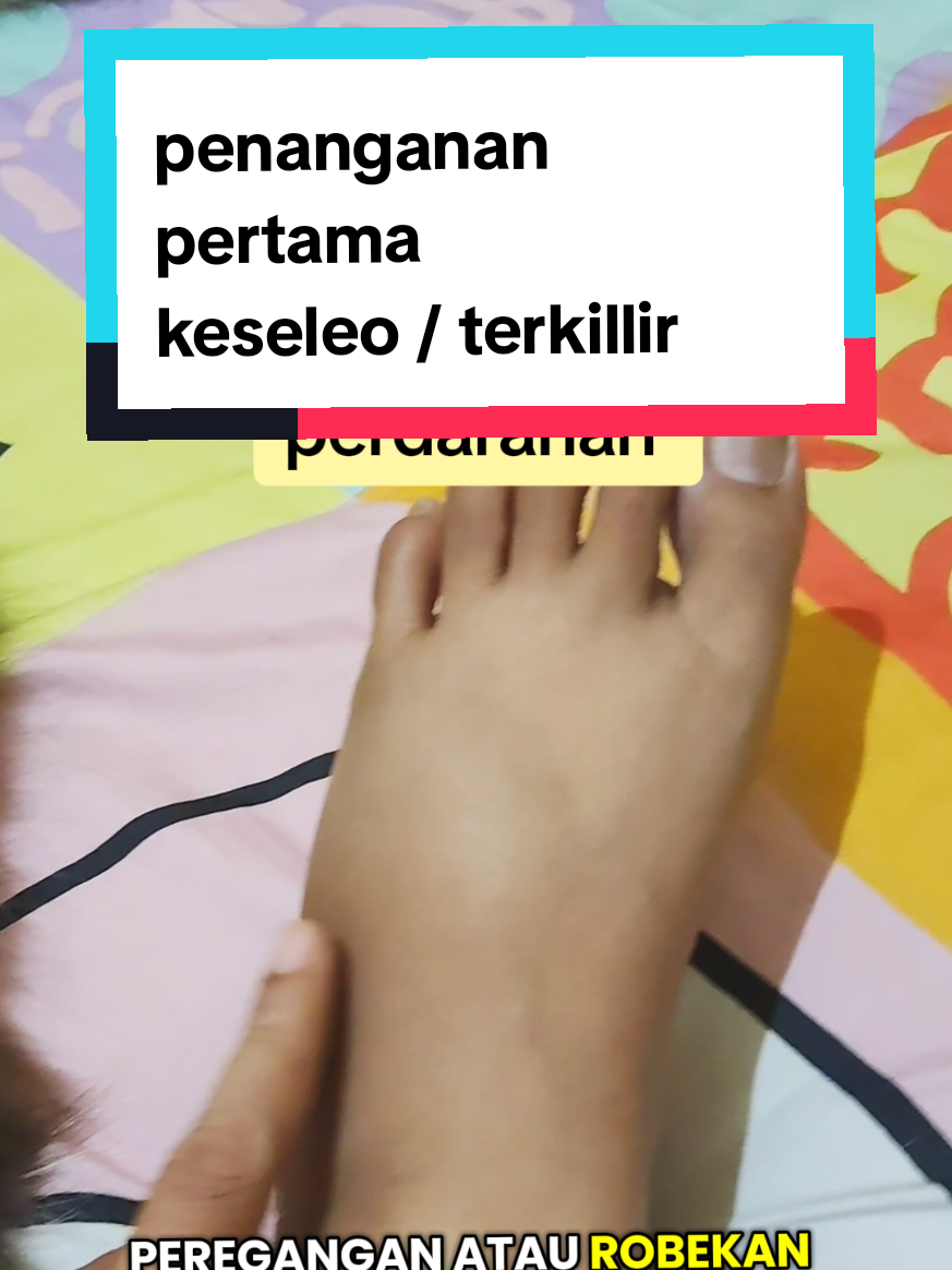 cedera otot atau kita biasa menyebutnya keseleo / terkilir .. memerlukan penanganan yang tepat agar tidak bertambah sakit dan mempercepat penyembuhan. Saya memakai metode RICE untuk penanganan pertama pada kaki saya yg terkilir. Semoga bisa bermanfaat dan menambah pengetahuan buat kita semua #wanita40an #lifejourney #aginggracefully #keseleo #terkilir #penangananpertama 