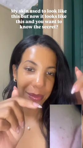 I’ve been trying out two amazing products that you can easily find on Amazon — and they’ve completely transformed my cleansing routine! Ultra Hyaluronic Cleansing Oil This oil cleanser melts away makeup, sunscreen, and impurities without stripping my skin. TXA Mucin Pore Mask Cleanser This is a 2-in-1 product: a deep-cleansing mask and a daily pore-refining cleanser. The texture is creamy and spreads easily, and you can feel it working to detox your pores while keeping the skin calm thanks to the mucin and tranexamic acid. It helps minimize redness and improves texture with consistent use. #korea #seoul #seoulglow #coxir #theskinhouse  @coxir 