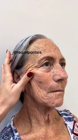 Se você quiser conferir mais sobre esse e tantos outros casos de rejuvenescimento que tenho, vai na rede vizinha 👉 @ raquelpontara 