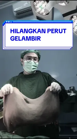 Sini kumpul yang perutnya bergelambir. bisa diatasi dengan Tummy Tuck di Beautylogica Clinic Pejaten #TummyTuck #PerutRata #Abdominoplasty #TummyTuckJakarta #KlinikKecantikanJakarta       