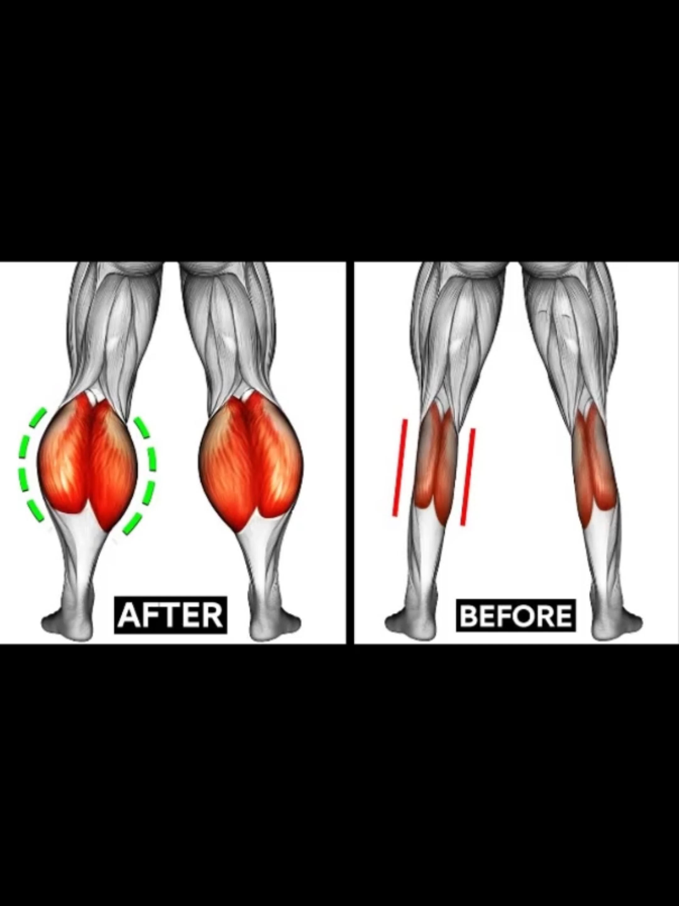How to get bigger CALVES? 💪🔥 #Fitness #gym #GymTok #workout #muscle #musculation #homeworkout #workoutroutine #FullBody #fullbodyworkout #CALVES #calvesworkout💪