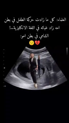 #الشامي_alshami🖤🥀 #الشعب_الصيني_ماله_حل😂😂😂 