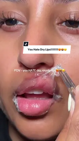 Lip care💋💋💋 #kbeauty #lips 