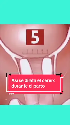 Dilatación durante el parto 😱🤰🏻 La dilatación es la fase más larga del parto. El cuello del útero se abre para que se produzca el nacimiento del bebé. 🙌🏼 Gracias a las contracciones uterinas, las fibras musculares del cuello del útero se van estirando, de tal forma que cada vez son más delgadas y así se consigue que se vayan abriendo. Al final el cuello del útero se dilata 10cm. 😨💜 ¿Has experimentado esto? Cuéntanos tu experiencia…  . . . . #ginecologia #ginecologa #AprendeEnTikTok #locuentoentiktok #parto #embarazofeliz 