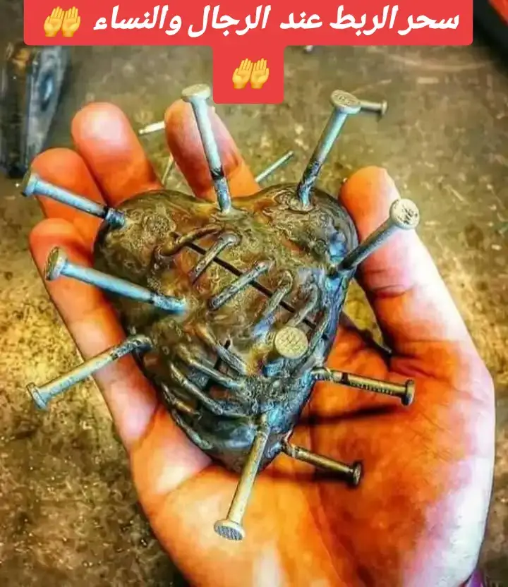 سحر الربط ...................... الربط معروف عند الجميع هو عدم الانتصاب عند الرجل وفى الغالب يحدث للعريس فى يوم زواجه لتسود حاله من الحزن فى اول ايام الفرح . و سحر الربط يحدث للرجل او المرأة او لهما الاثنين وهو على انواع كثيرة ومتعددة فمنها ربط للرجل مع زوجته ومع غيرها ويسمى ربط قريب وبعيد . و الربط فقط عن زوجته ويسمى ربط قريب ويكون مخصص له ولزوجته باسمه واسمها . و الربط البعيد وهو اصعب لان اغلبه اما بالنجوم او بالنجاسة او مشروب او مأكول او مدفون فى مقابر . وايضا يوجد ربط يسمى ( الربط نفسي ) وهذا حالة نفسيه حيث يشعر بعدم الرغبة مع انه وهو برى عنده رغبه . والربط المرضى واغلبه عند الزوجة دائما تشعر بمرض شديد وهناك ربط جزئي لا يكون انتصاب كامل وقت الجماع فقط وكذلك يوجد ربط لعدم الانجاب ويسبب انعدام الحيوانات المنوية او ضعفها جدا اما ربط الزوجة تظهر اعراض عند الجماع مثل الرعشة حرارة فى الجسد او التهابات شديده او نزيف او تصلب الجسد او النفور الشديد مع عصبية شديدة او اغماء وقت الجماع او احساس بدوخة وعدم تركيز او احساس بالبرود الكامل وكأن الموضوع لا فرق فيه علاج سحر الربط : لكل نوع من انواع سحر الربط له طريقة في فك السحر لكن هناك طريقة تكون مشتركة في علاج جميع انواع الربط وهي كالاتي نأتي بماء ونقرا عليه الفاتحة 7 مرات والبقرة 1 والصافات والدخان ومحمد وطه والزلزلة والكافرون والاخلاص والمعوذات 3مرات واخذ قليل من الماء مع قليل من ملح ونضعهم على ماء ويشطف بهم  الرجل وزوجته فى اناء خارج الحمام لمده ثلاثة ايام مع الاستمرار بقراءة نفس السور والله المستعان و هو الشافي#السعودية #الكويت #الامارات #البحرين #عمان #الاردن #العراق #قطر #الدمام #الشارقة 