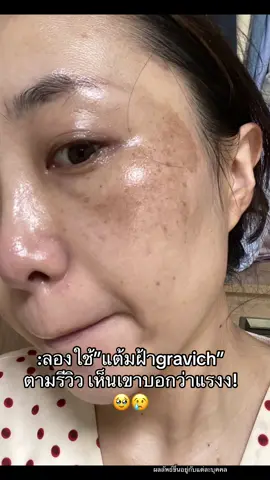 แอบแรรง แต่คุ้้มถ้าฝ้ากระหาาย! #ฝ้า #ฝ้าแดด #แต้มฝ้าgravich #gravich #ใช้ดีบอกต่อ 