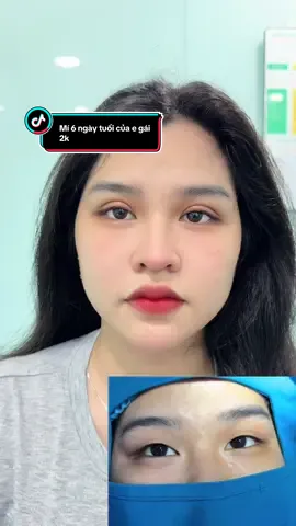 Từ khi e có cặp mí mới.. e hay cười và tự tin lên hẳn nè.. mí 6 ngày tuổi nha ce #cắt_mí_đẹp #mí_phượng_hoàng #mắtđẹpmíđẹp #xuhuong #thịnhhành #tạo_mắt_2_mí #sai_gòn #dr_halee 