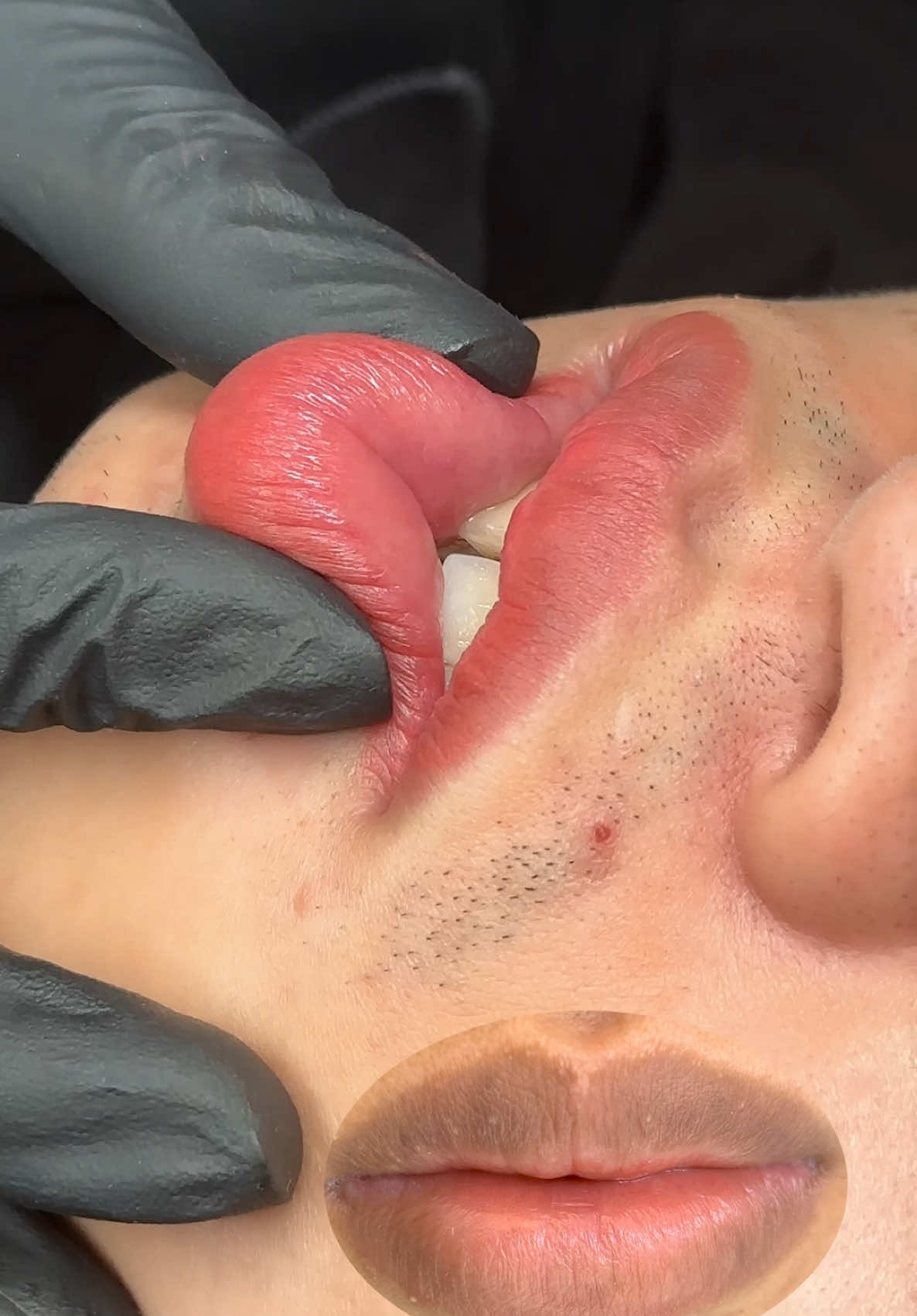 Khử thâm môi nam đơn giản chỉ với màu cam sữa và hồng đào #phunmoi #phunmoidep #phunxamthammy #khuthammoi #hocphunxam #mucphunxamcelict #khuthammoinam 