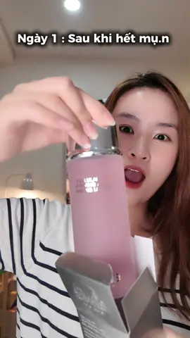 Ngày 1 : sau khi hết mụ.n ?🛁🧼🤩😬😂#rinabeauty #lamdep #skincare #beauty #trending #xuhuong #skincaretips #skincareroutine #viral #trend 