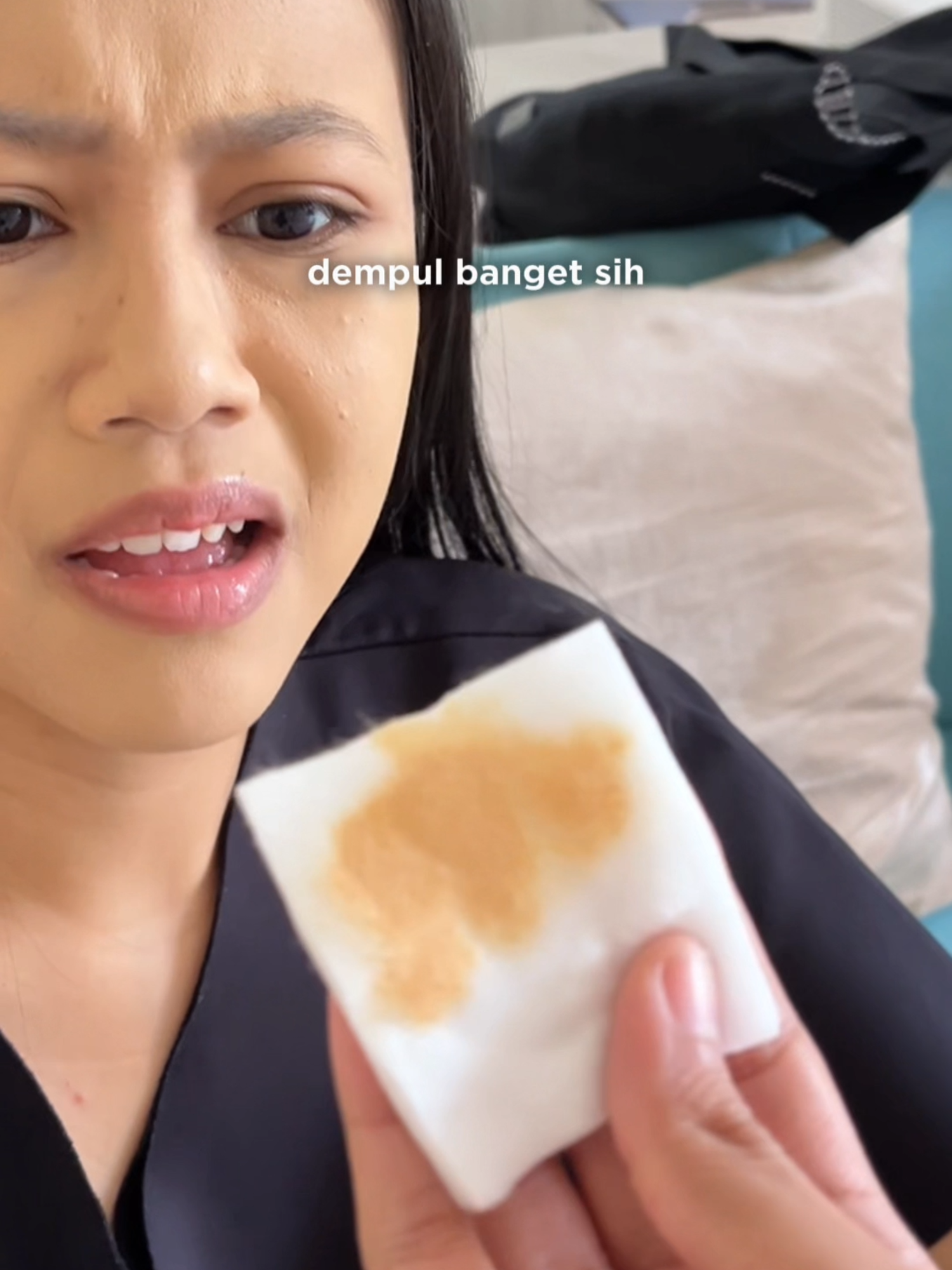 Dikirain doyan full makeup tiap hari, Eh ternyata… buat nutupin dark spot 😢 Langsung aja aku racunin skincare brightening dari Azarine dan tonton sampai akhir buat liat progessnya!! #azarine #azarineproduct #azarineskincare #azarineskincareroutine #azarineskincareproduct #skincareroutine #skincaretips #skincarebrightening #fyp