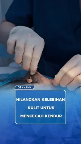 Bagaimana operasi facelift mengubah kulit? #indonesia #fypツ #jakarta #fyp #viral #smasfacelift #lips #eyelids #facelift #smasfacelift 