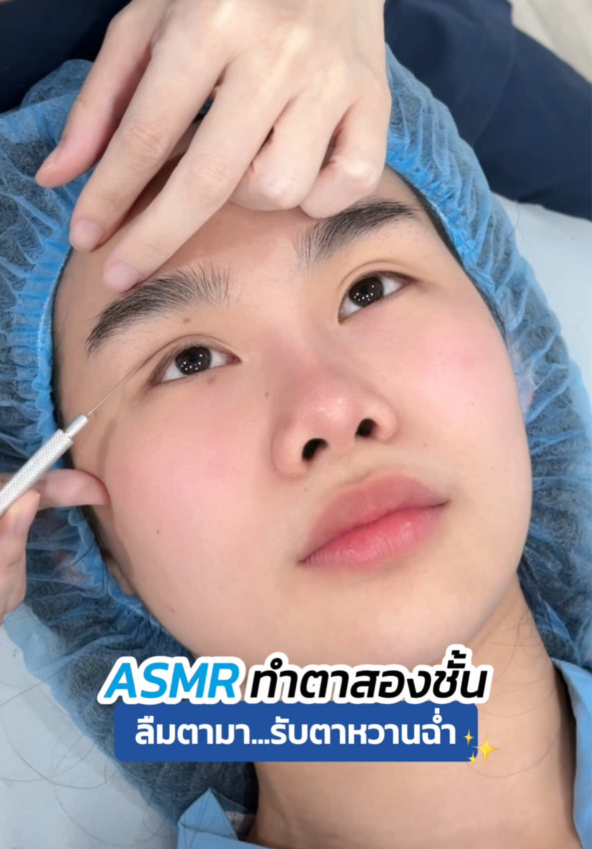 #asmr ทำตาสองชั้น ✨ ทำเสร็จรับตาหวานฉ่ำ 💖 #รีวิวตาสองชั้น #skyclinic #หมอสกาย #จักษุแพทย์ #ทำตาที่ไหนดี #สกายคลินิก 