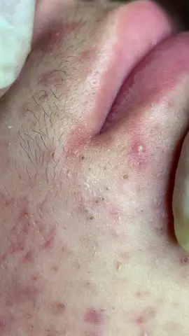 Ngon #chamsocdaseo#chamsocda#chamsocdamun#chamsocdanam#tanbinh#govap #Lequynh       