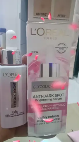 #เทรนด์อันดับ1วันนี้  L'Oréal  #serum ใช้ดีบอกต่อ