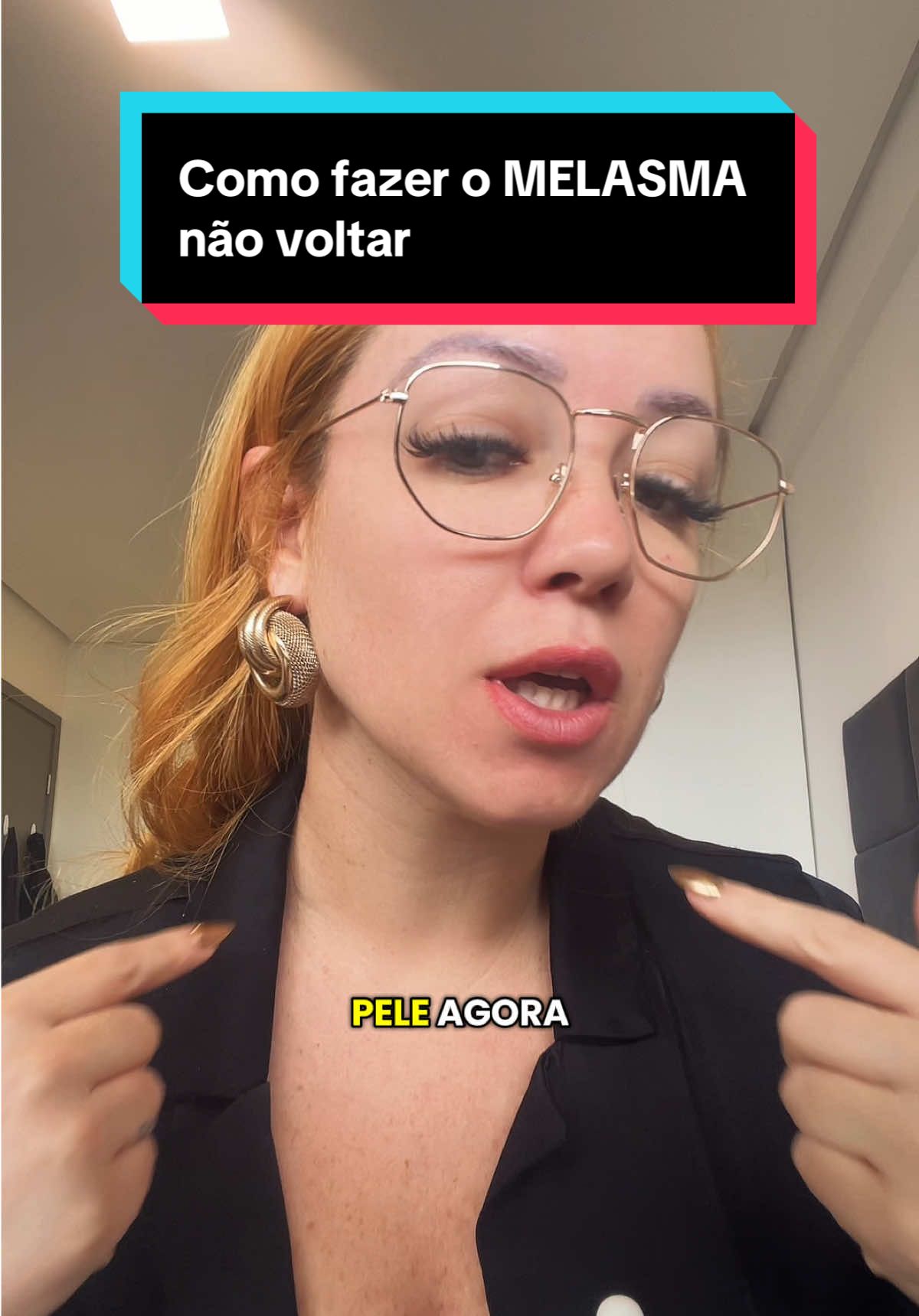 Como curei o meu melasma #skincare #despigmentação #manchasnorosto #melasma 