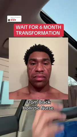 Replying to @Theophania 36 years old feeling like I’m 25 again @Cata-Kor USA #catakorpartner #nad #tiktokshopcreatorpicks #antiaging #dealsfordays 