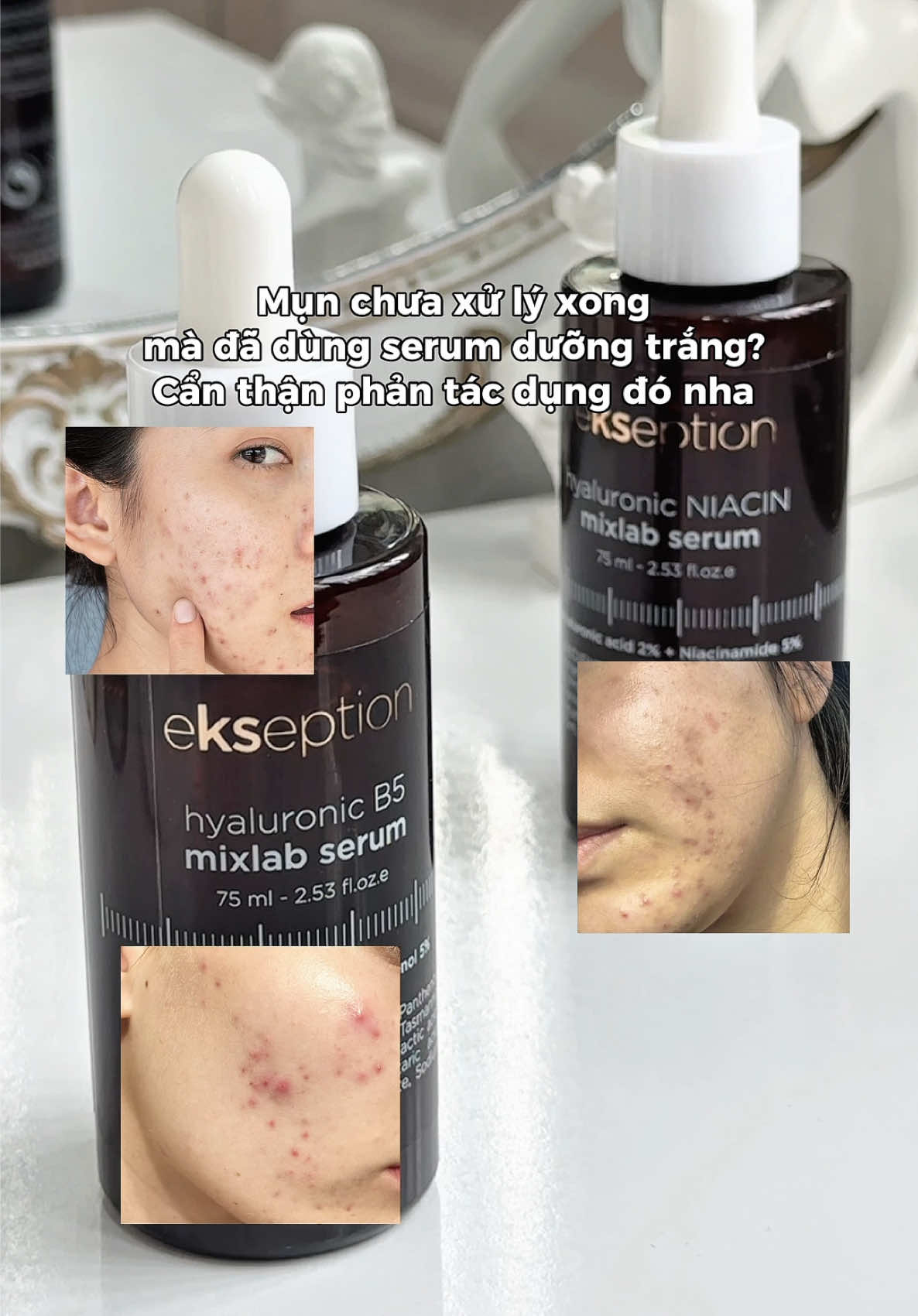 Phục hồi làn da nhạy cảm, sau peel, treament…. với Serum B5 của Ekseption #ekseption #serum #skincare #b5 