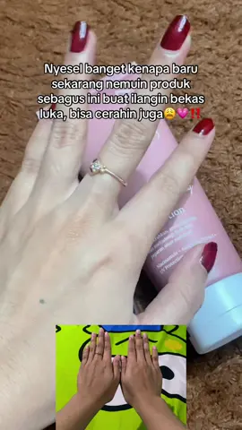 No buzerr buzerr!! @SHERIZ @OWNER SHERIZ  #bodycare #pemutihbadan #sheriz #sherizbodylotion #bodylotion #bodybooster #GlowUp #kulitcerah #bodycareroutine #kulitsehat 