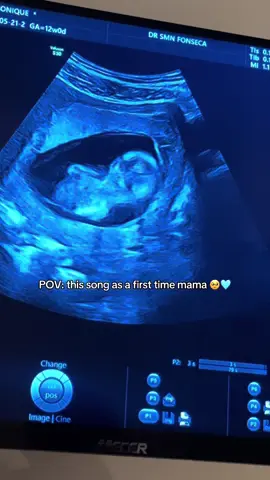 I didn’t know a love like this existed until I heard your heartbeat 🤍 You’ve already made my world feel softer, slower, and crazier in the best way. This song hits different now 🫶 #Crazier #HannahMontanaMovie  #BabyOnBoard #UltrasoundMagic #PregnancyGlow #MumTok #BumpUpdate #PregnancyJourney #TinyHeartbeat #FirstTimeMum #MomToBe #BabyLove #EmotionalTok #SoftLifeEra #BabyBliss #BabyTok  #PregnancyVibes