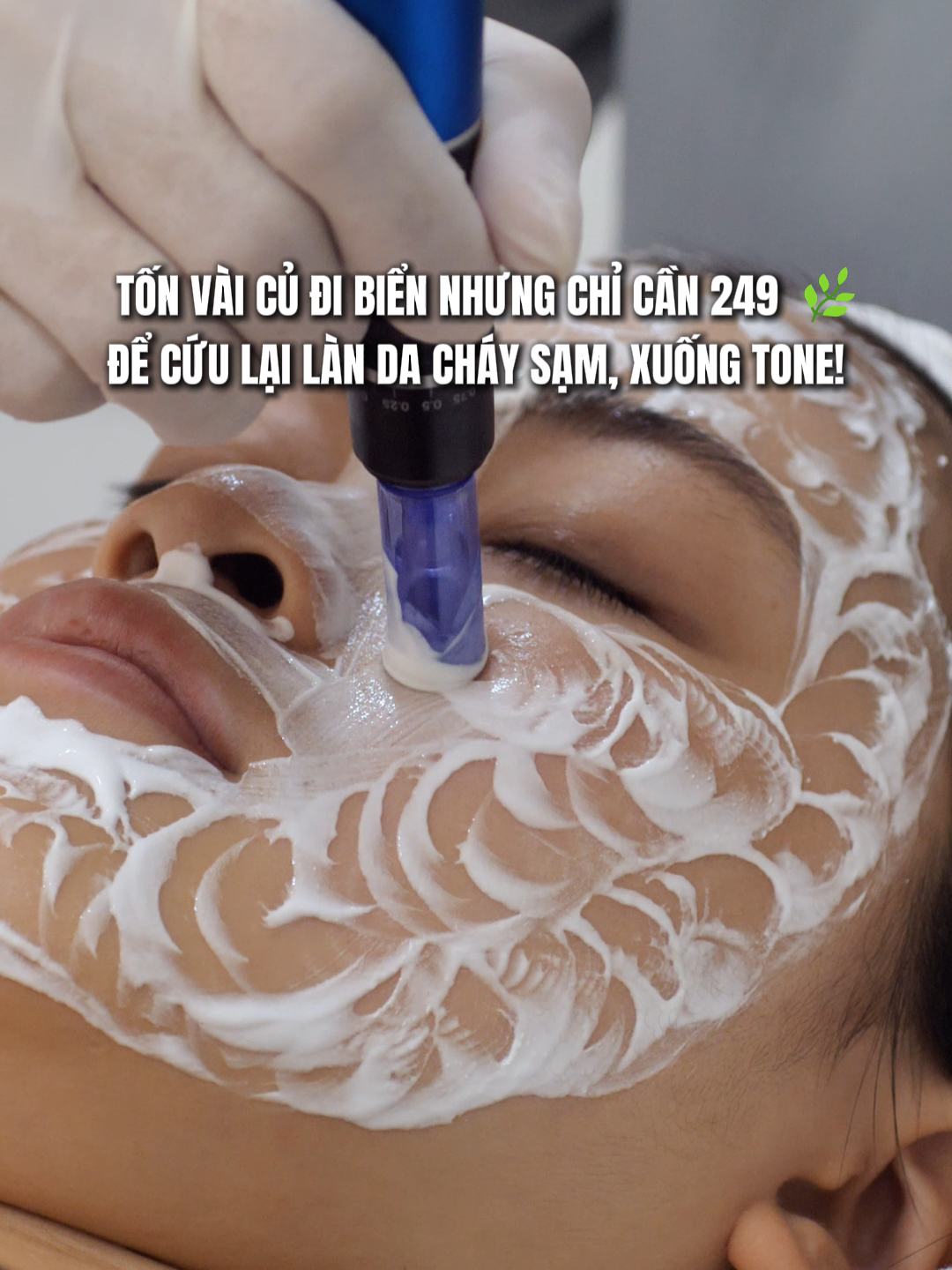 Tốn vài củ đi biển nhưng chỉ cần 249 cành để cứu lại làn da cháy sạm, xuống tone! #mialalanhatrang #spanhatrang #caytrang #caytranghistolab #xh