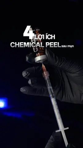 DA MỤN – KHÔNG CHỈ CẦN NẶN, MÀ PHẢI ĐƯỢC “PEEL” ĐÚNG CÁCH! Peel mụn không đơn thuần là làm sạch da – đó là bước khởi đầu giúp da bạn tái sinh. 💥 Lấy đi lớp sừng dày, bít tắc – nguyên nhân hàng đầu gây mụn 💥 Làm sạch sâu lỗ chân lông, hỗ trợ gom cồi – khô nhân mụn nhanh chóng 💥 Kích thích da tái tạo lớp biểu bì mới: mịn hơn, khỏe hơn, sáng hơn từng ngày 👉 Nếu bạn đã từng nặn mụn nhưng vẫn lên lại, da vẫn sần sùi, viêm đỏ… thì peel mụn chính là lời giải! Tại spa, peel mụn được thực hiện chuẩn y khoa – không đau rát – có máy làm dịu da ngay sau đó, giúp khách cảm thấy dễ chịu, da phục hồi nhanh. 📩 Inbox đặt lịch để được chăm sóc da mụn đúng cách – chuẩn khoa học ngay hôm nay! Số lượng ca peel mỗi ngày có giới hạn để đảm bảo chất lượng dịch vụ – giữ chỗ ngay hôm nay nha bạn ơi! #tss #tssglowlab #videoviral #spa #chemicalpeel 