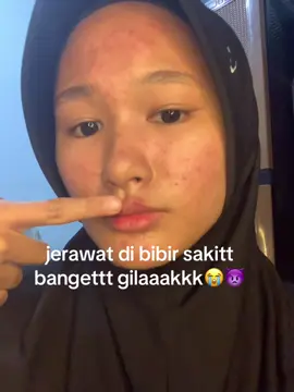 ngomong ajaa skitt bettt#fyp #trending #acnefighter 