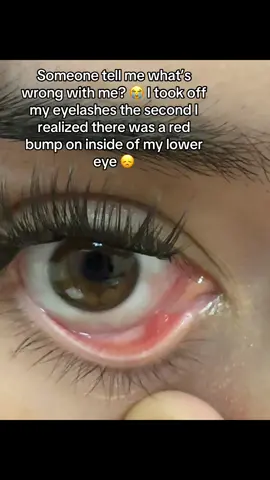 I’m scheduling a doctors appointment rn 😭 #fyp #eyes #help #az #itsnysaa