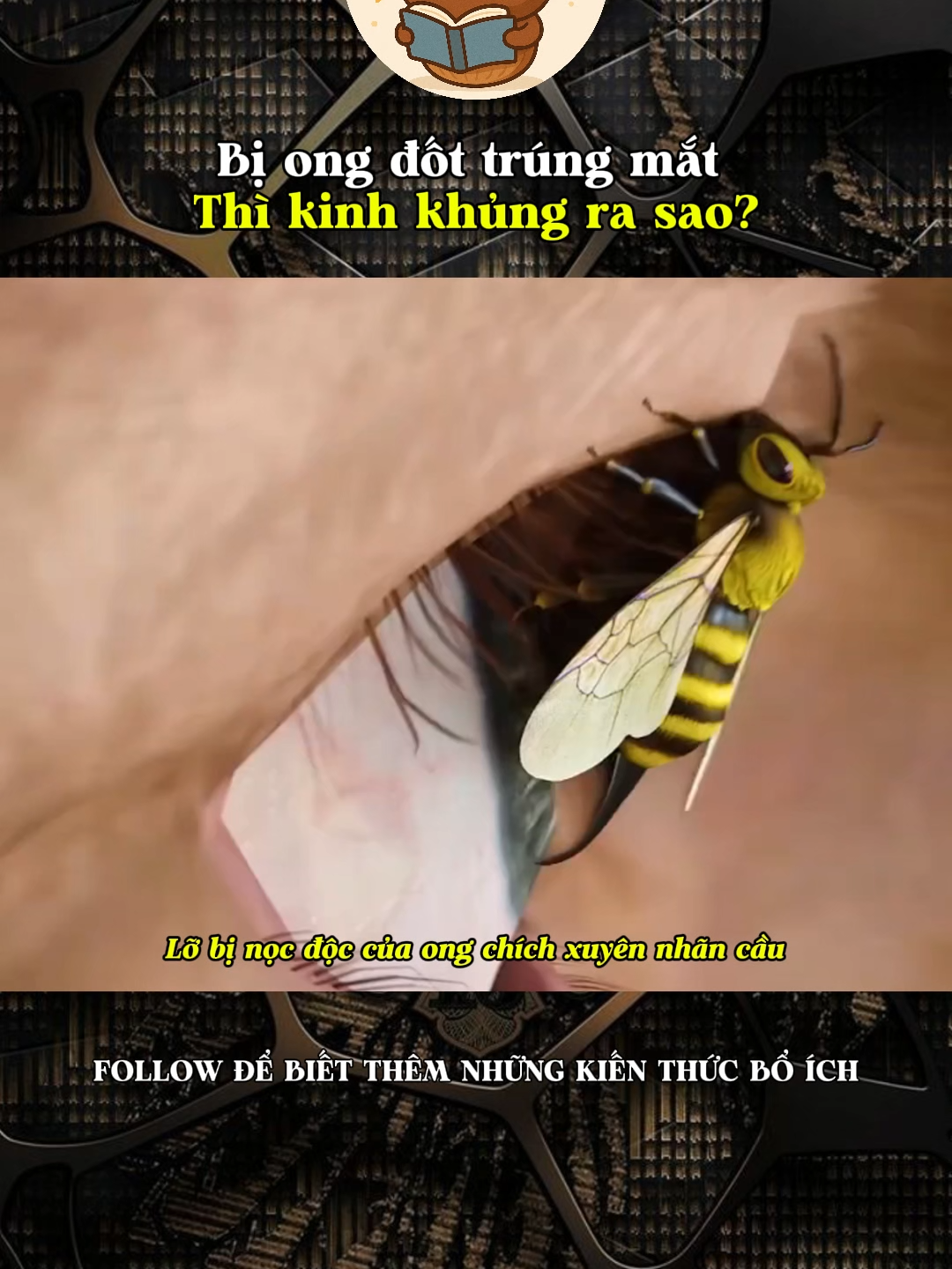 Bị ong đốt trúng mắt thì kinh khủng ra sao?#kienthucthuvi #khoahoc #khampha #LearnOnTikTok #kienthuc #xh