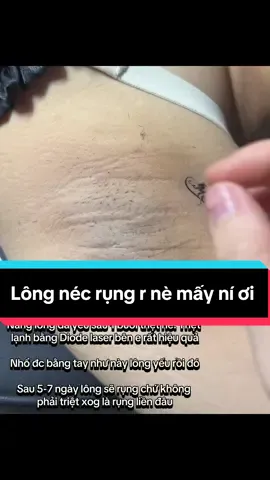 Khách nhà em triệt lông 1 buổi và sau 7 ngày thì nag lông sẽ yếu và rụng rồi nè #trietlong #trietlongvinhvien #chamsocda #chouchoubeauty #feedback #tpvinh #37nghean #spa #nanmun #chanmay 